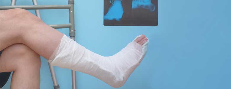 Dr. Tranquilino Carlos - Fracturas